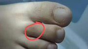 被毒蛇咬伤，广东哪些医院有抗蛇毒血清？这份名录请收好！