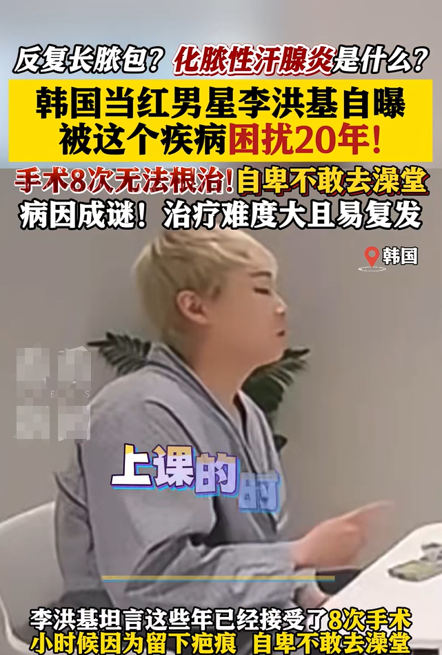 男星李洪基自曝患罕见疾病20年，手术8次无法根治，病因成谜！自卑不敢去澡堂