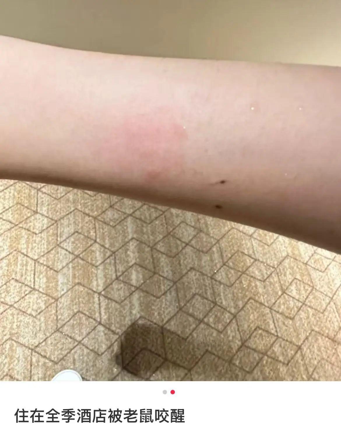 女子入住南昌全季酒店半夜被老鼠咬醒，投诉人：酒店赔偿5000元