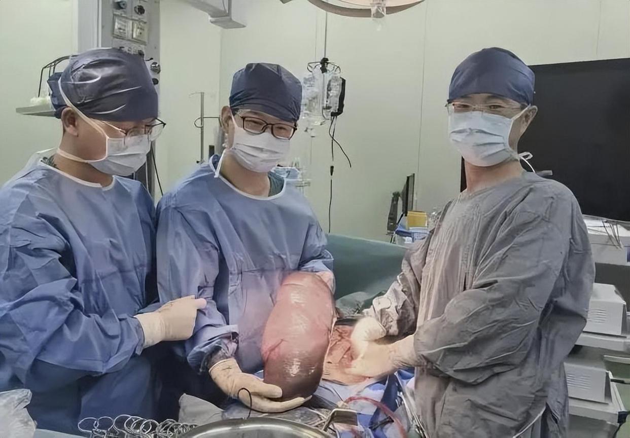 上海女子肚子越来越大，暴瘦20斤！医生一查惊了：她体内有一个“庞然大物”